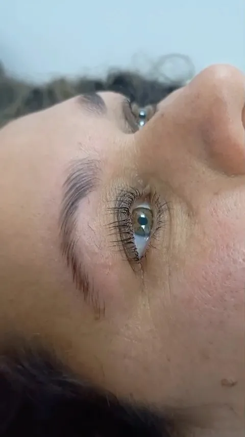 Limpieza facial profunda 